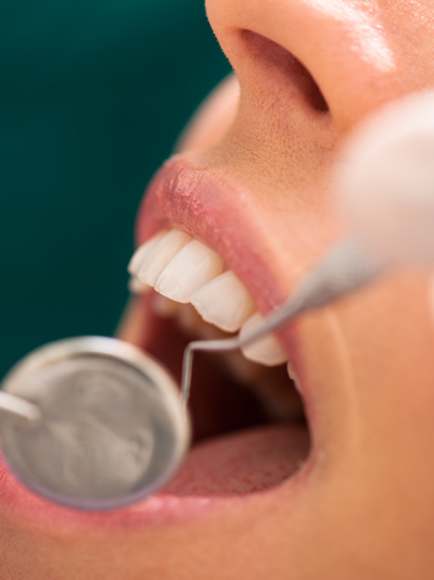 Periodontal Maintenance in Elizabethtowne, KY